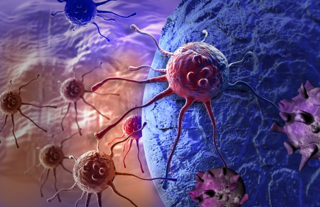 Revolucionarno dostignuće švajcarskih naučnika: Ćelije agresivnog raka dojke pretvorili u salo
